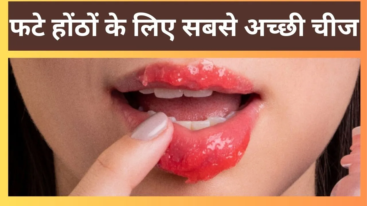 Chapped Lips (1)