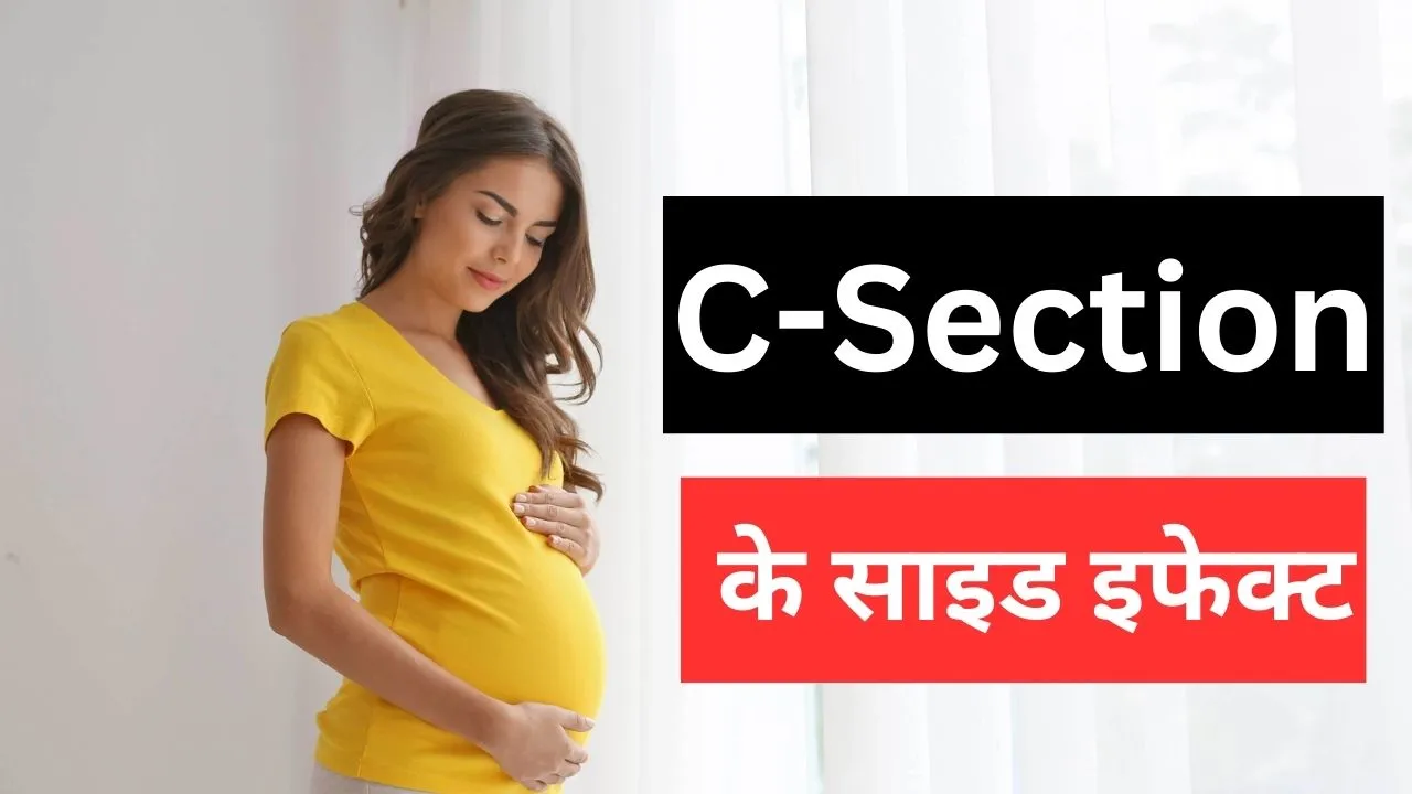 C-Section