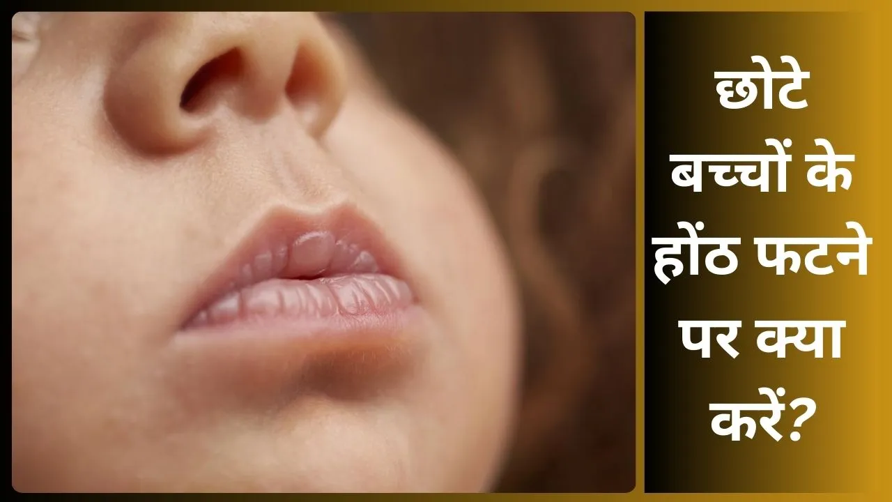 Natural remedies for baby dry lips (1)