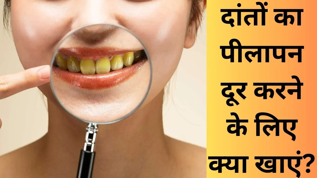 yellow teeth