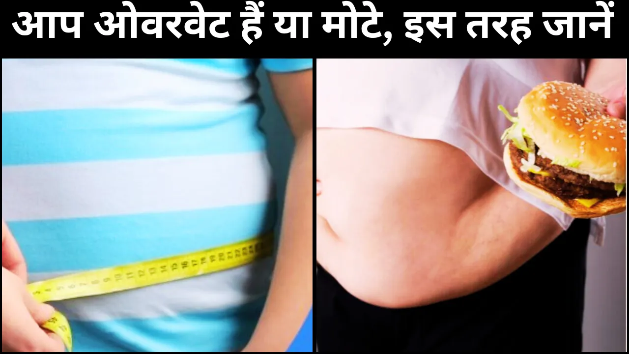 world obesity day 2025