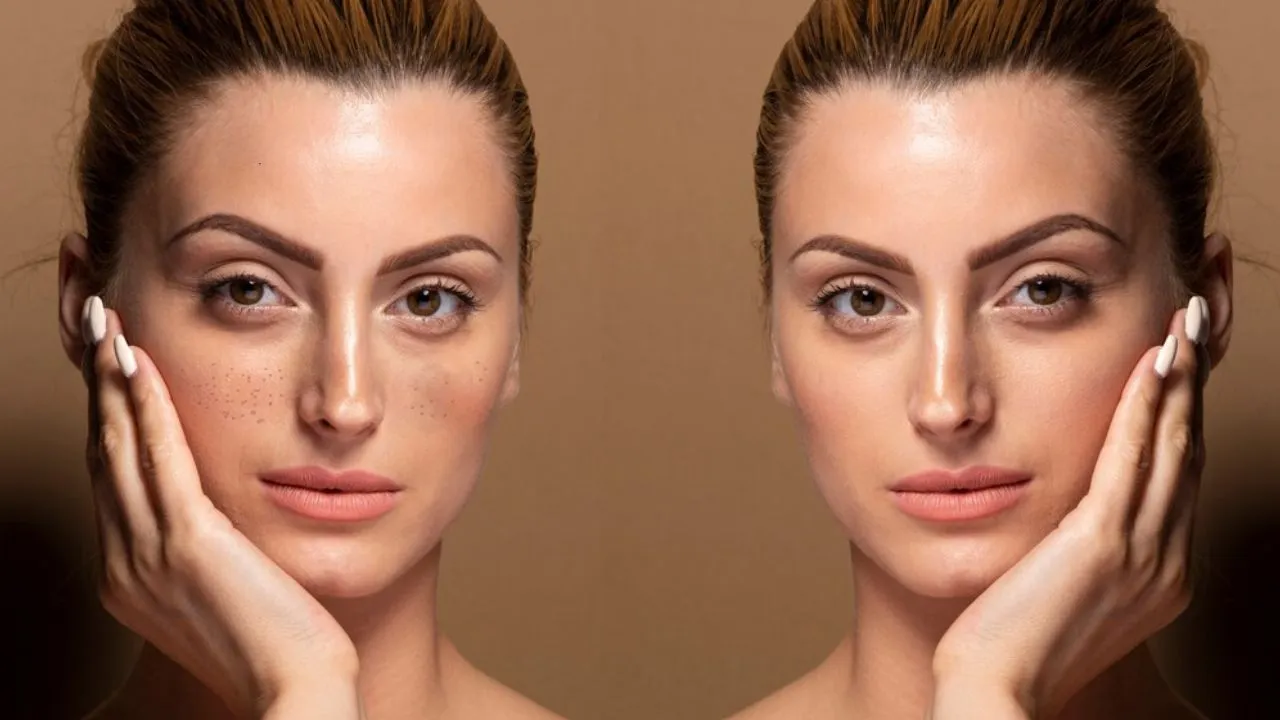 Skincare Routine For Hyperpigmentation