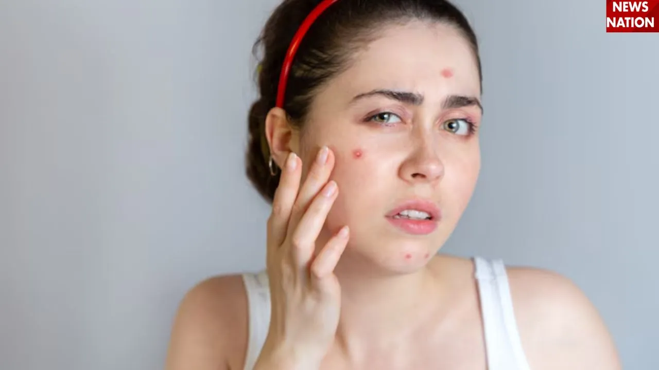 पिंपल फोड़ने