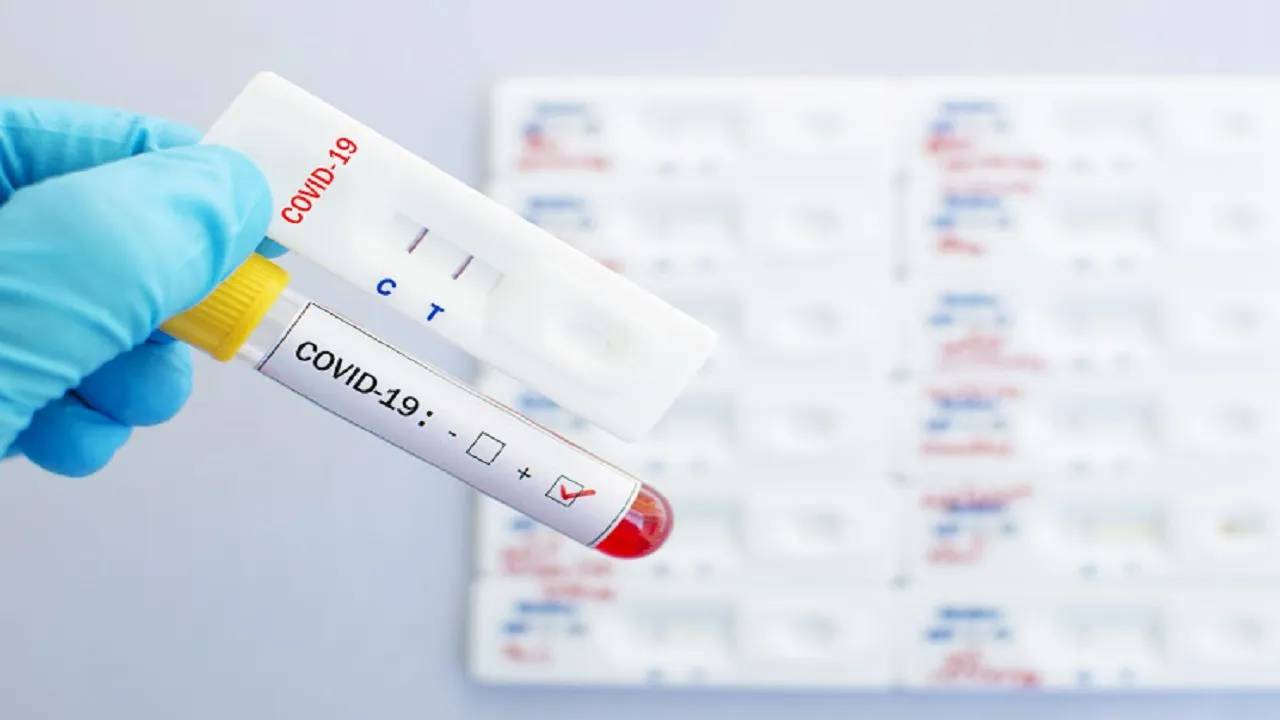 COVID-19 Test