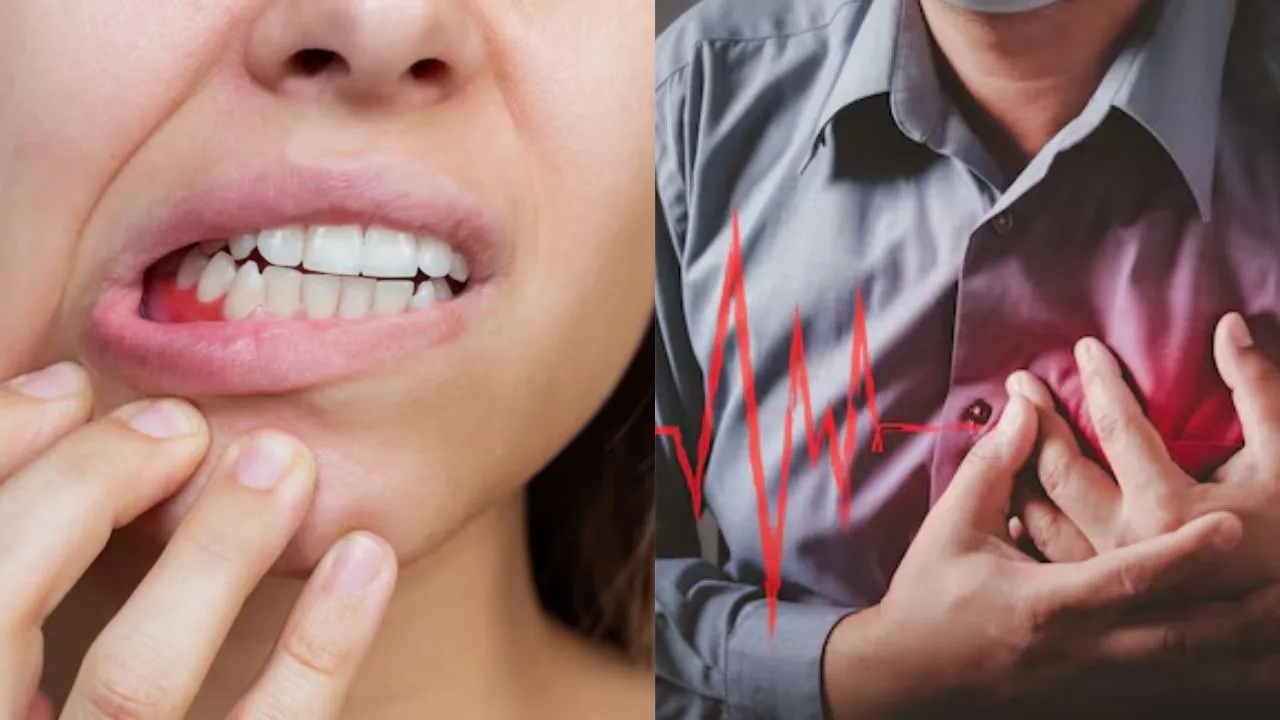 gum disease
