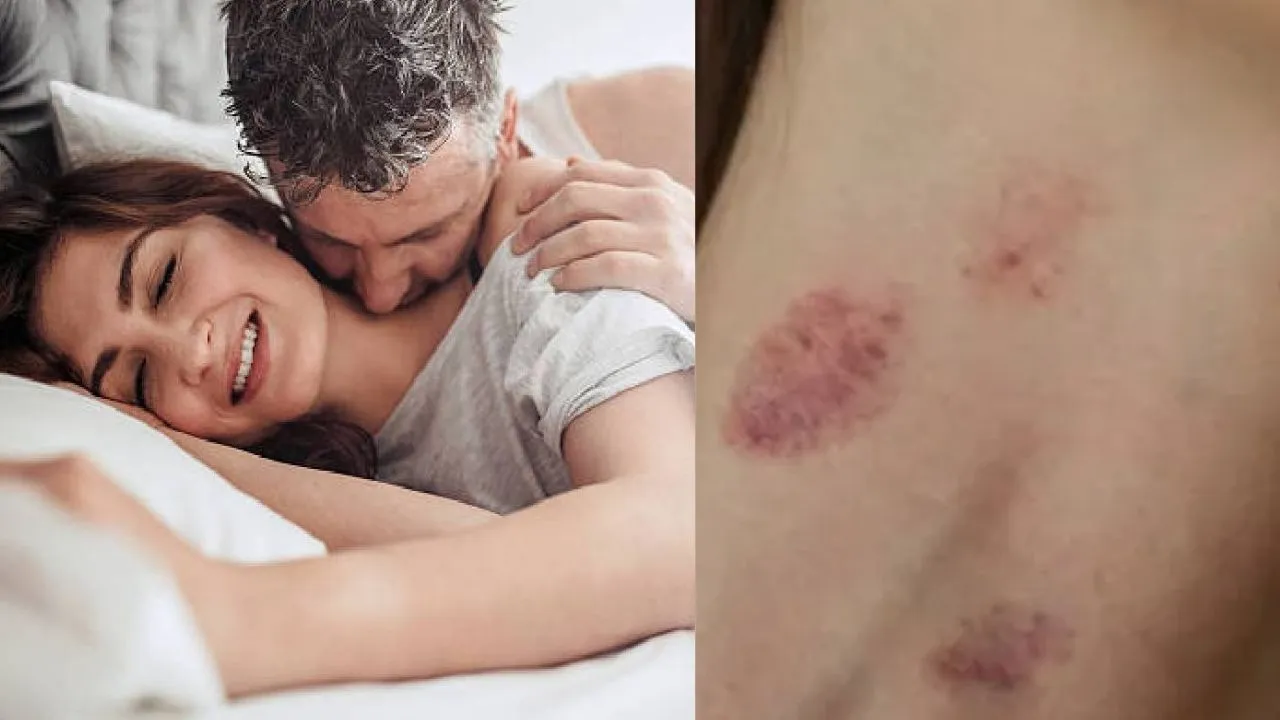 Love Bite