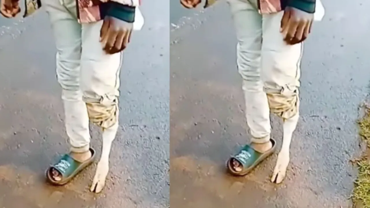 viral leg video