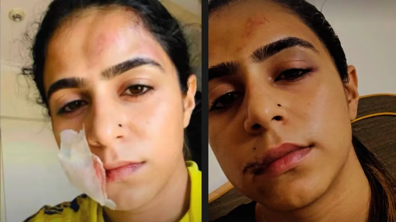 this actress made serious allegations of on her ex boyfriend said He kicked me in the stomach