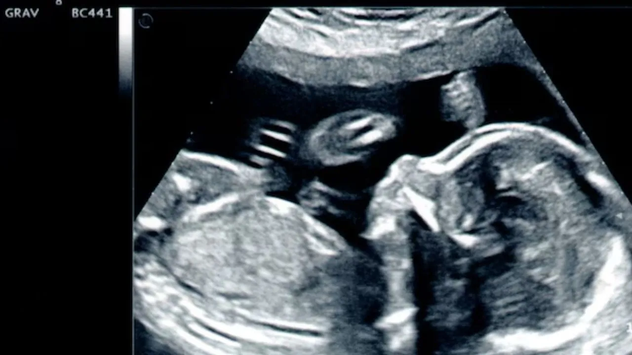PC-PNDT Act Explained Law Against gender Selection in hindi Gender Test Ban from ultrasound gender Ratio