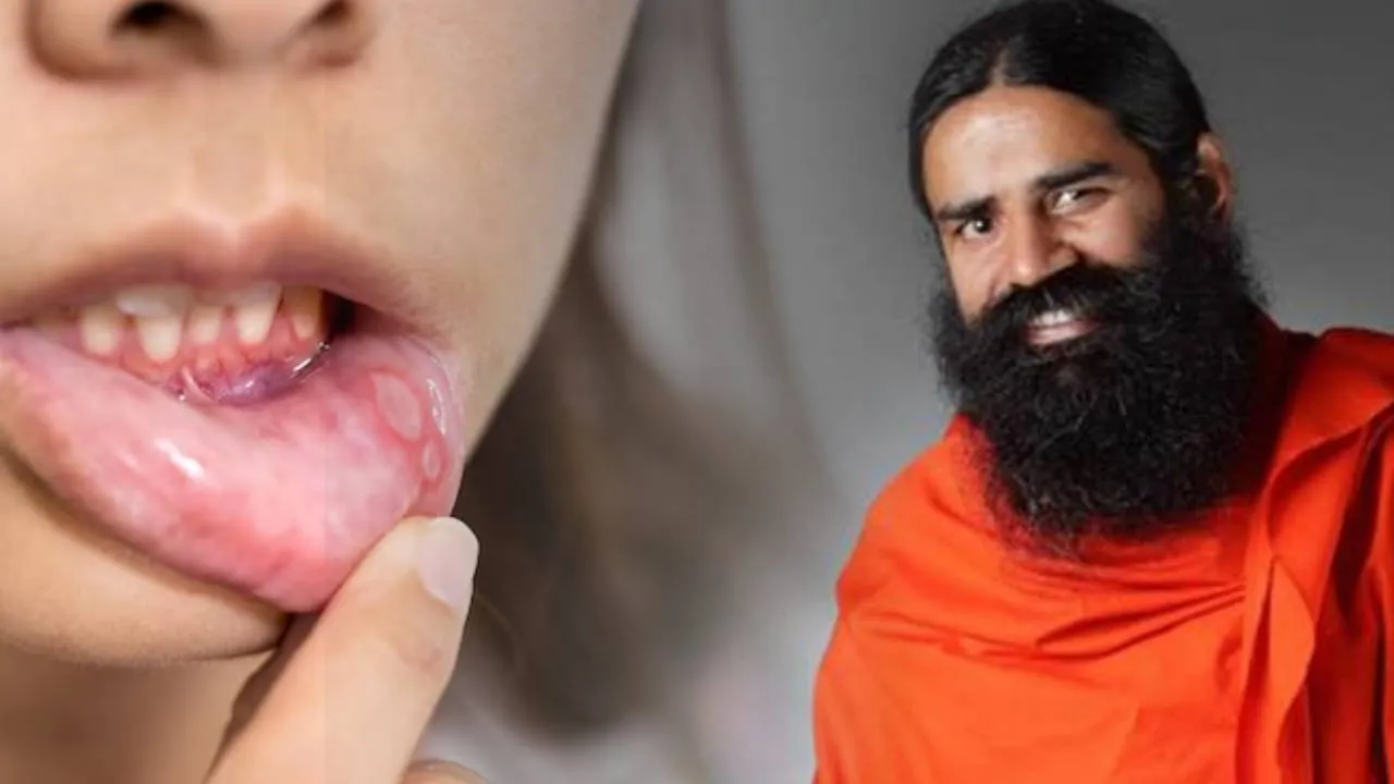 Baba Ramdev Tips to cure Ulcers