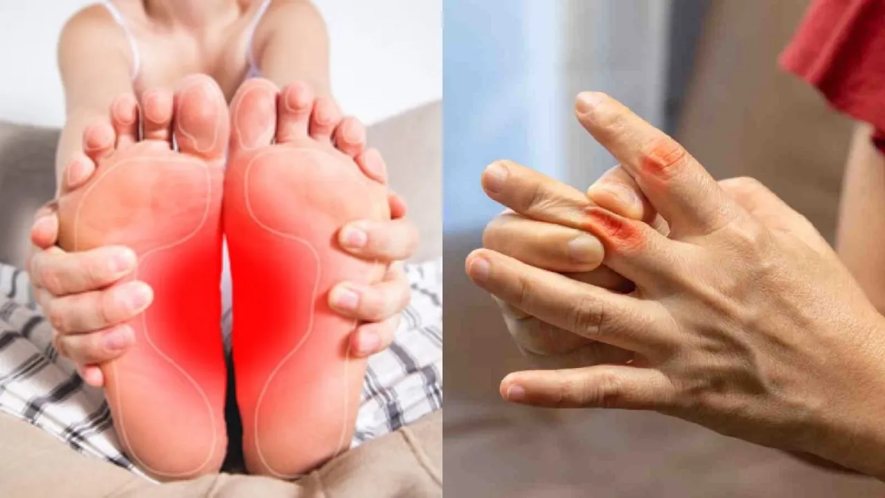 Finger And Toe Swelling In Winter