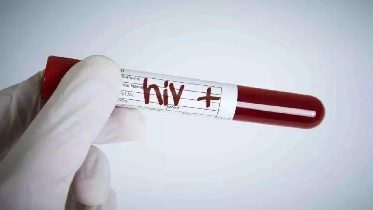HIV Positive children