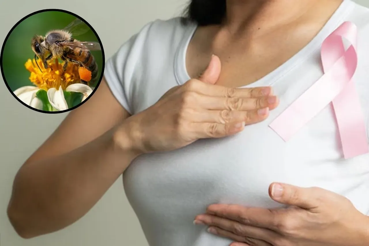 Honeybee Venom and Breast Cancer