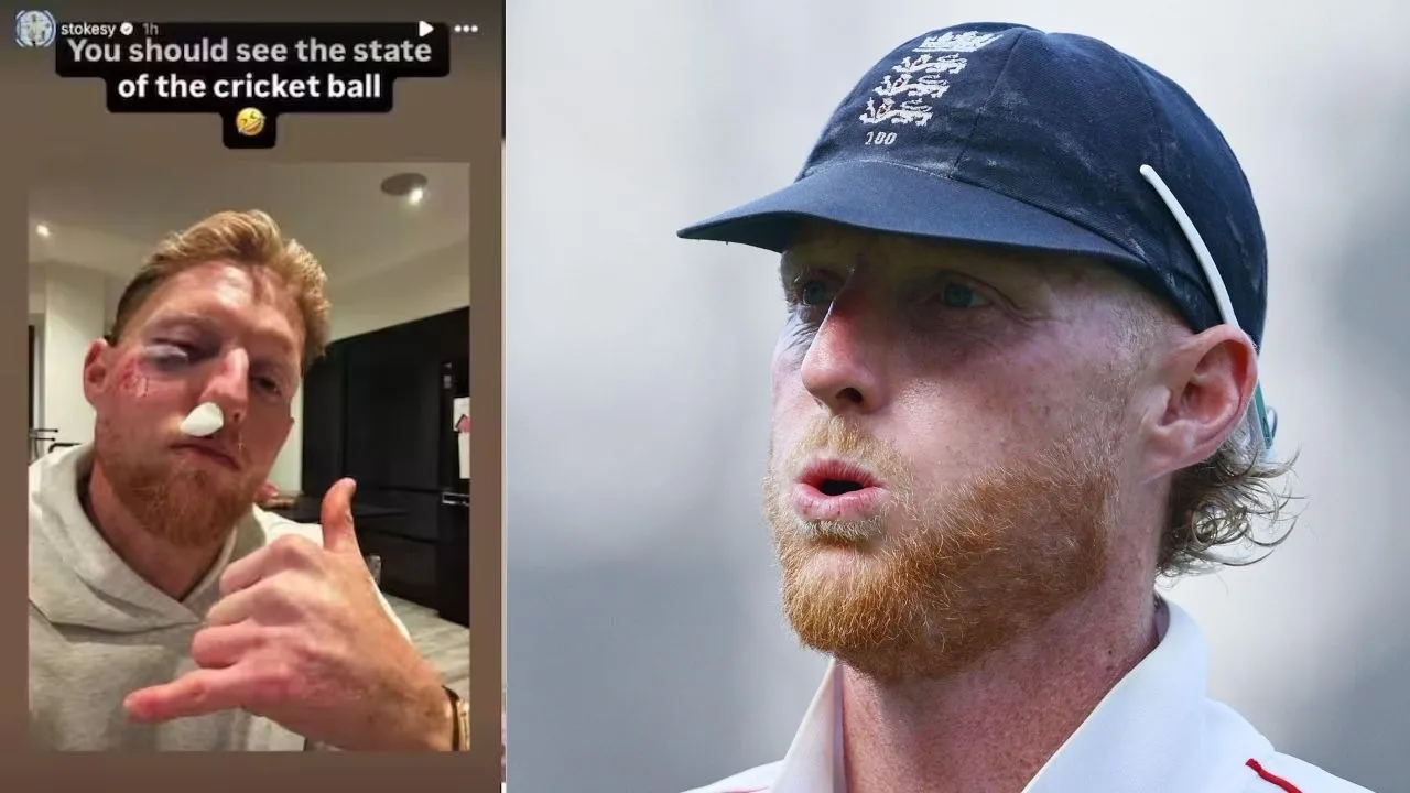 Ben Stokes posted a picture of the injury to his face and explained what happened