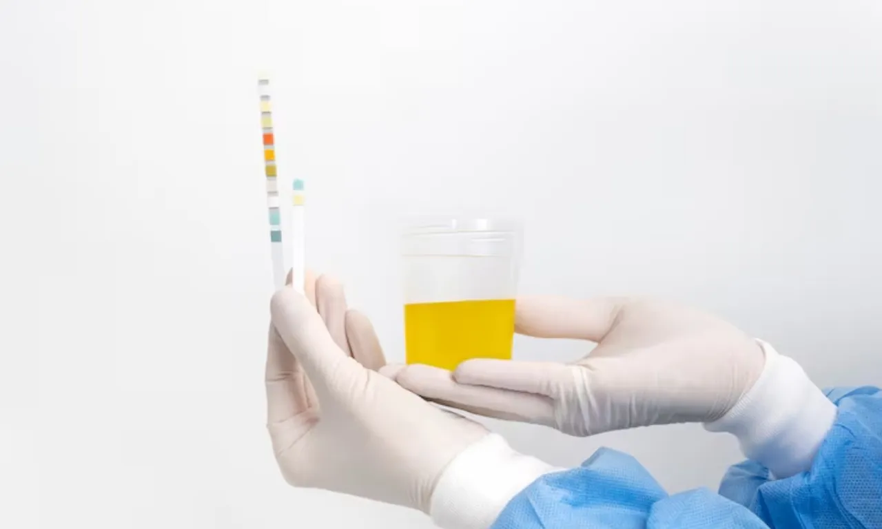 kidney failure signs 3