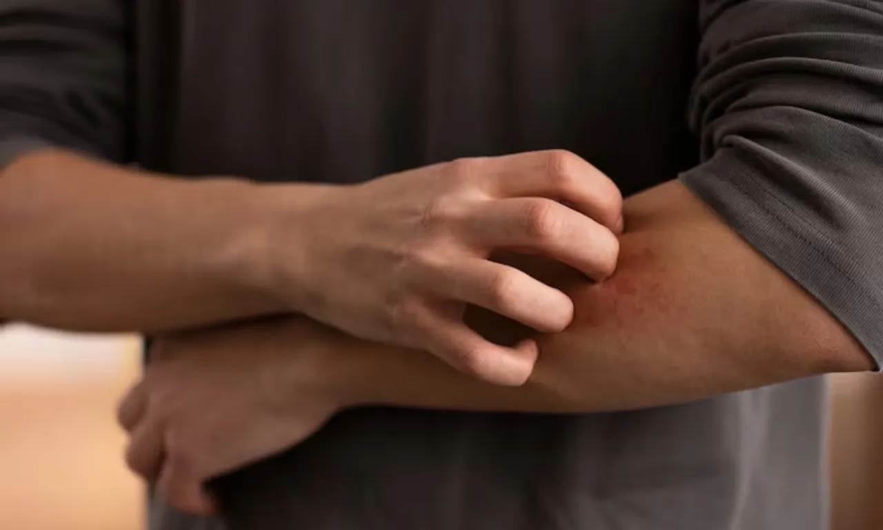 kidney failure signs 5