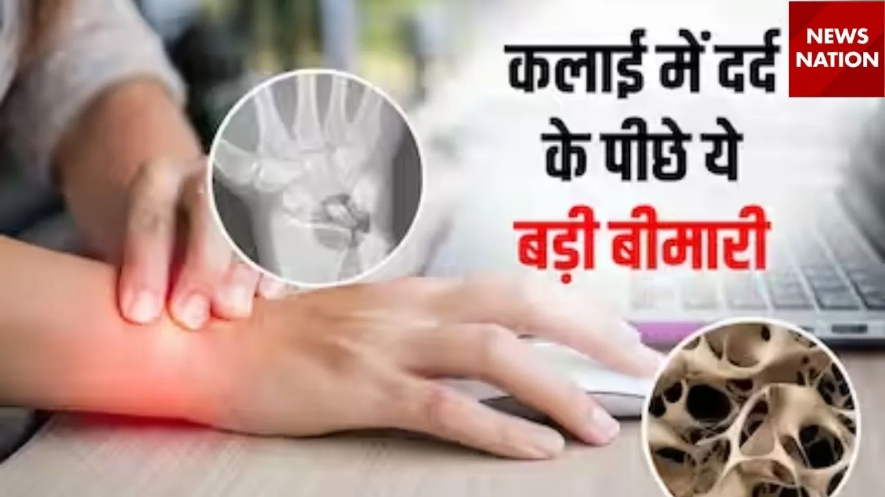 Carpal Tunnel Syndrome