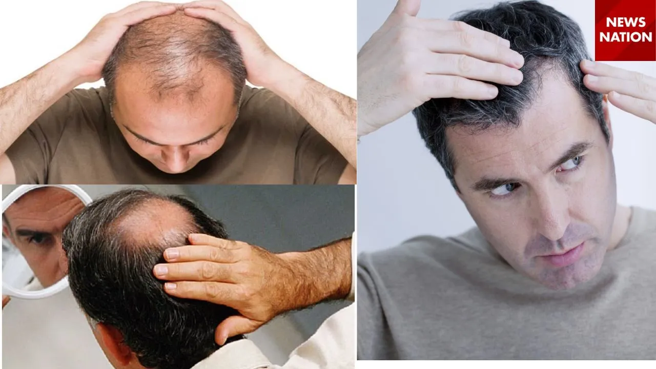 Baldness