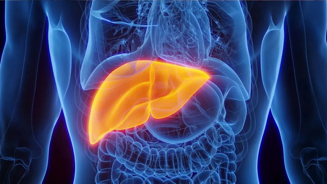 Fatty Liver 1