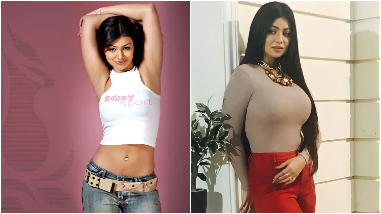 Actress Breast Surgery (4)