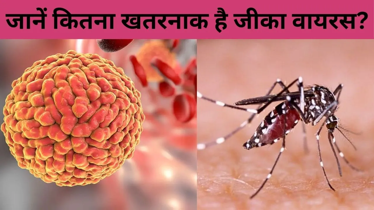 Zika Virus