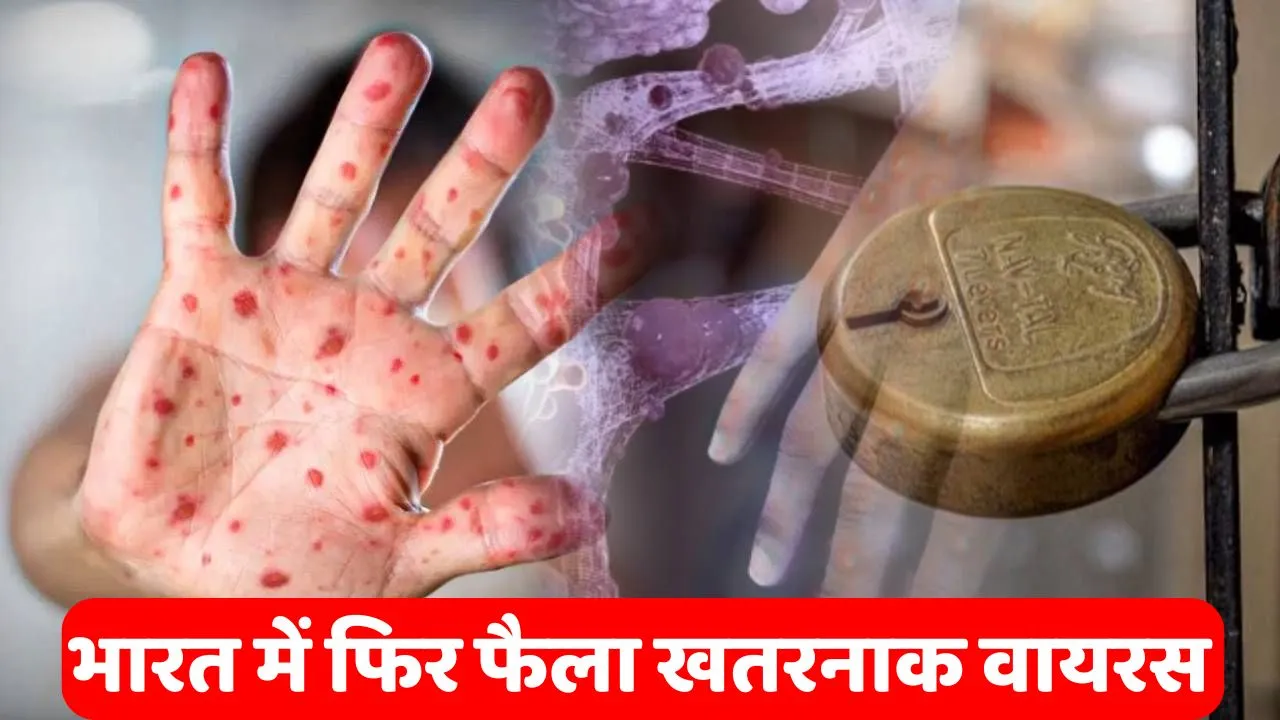 Monkey Pox Virus News