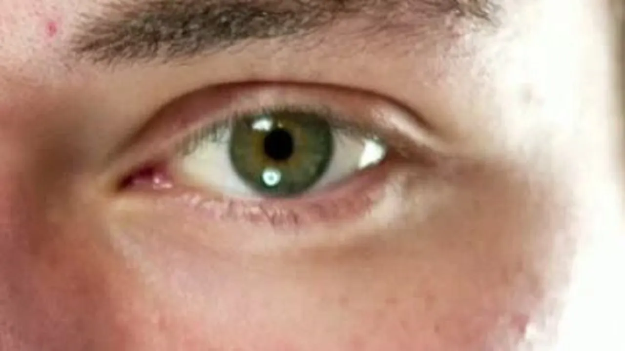eye 