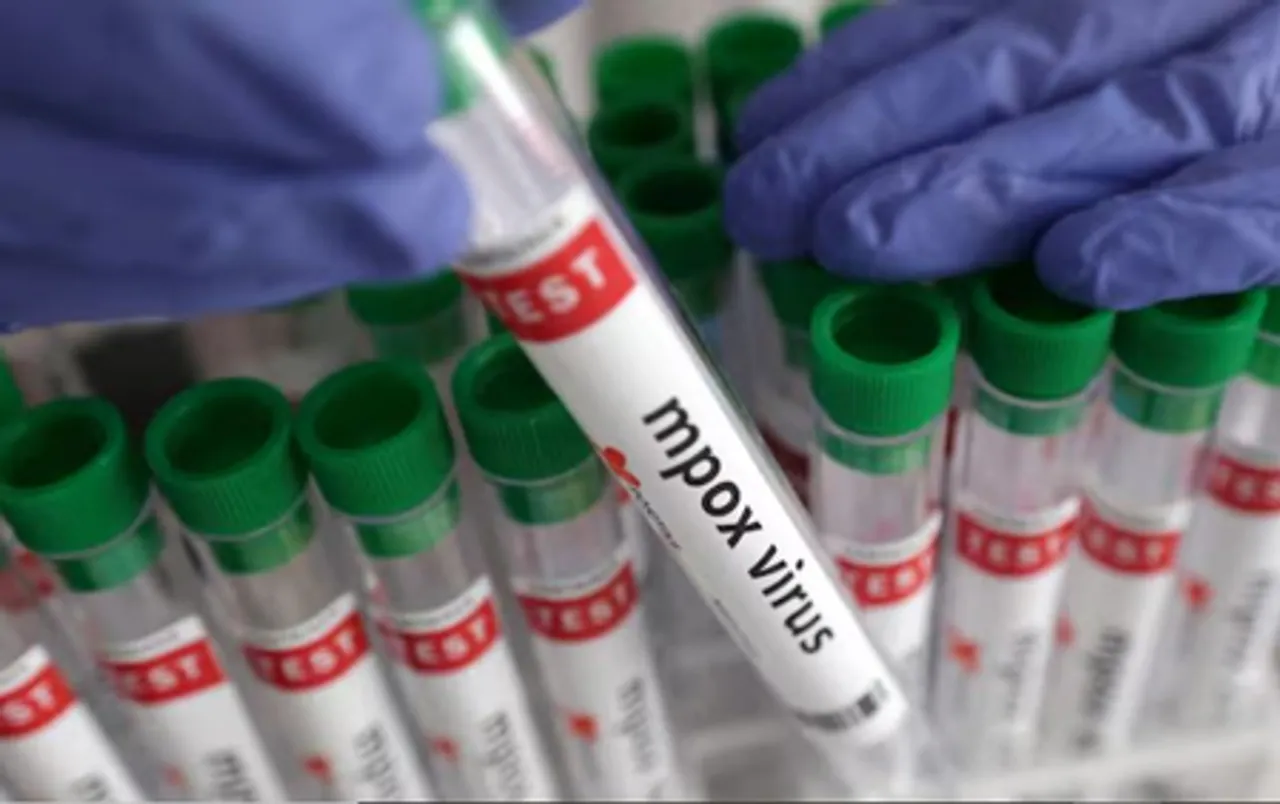 Uganda's mpox cases hit 8,001 as infections decline