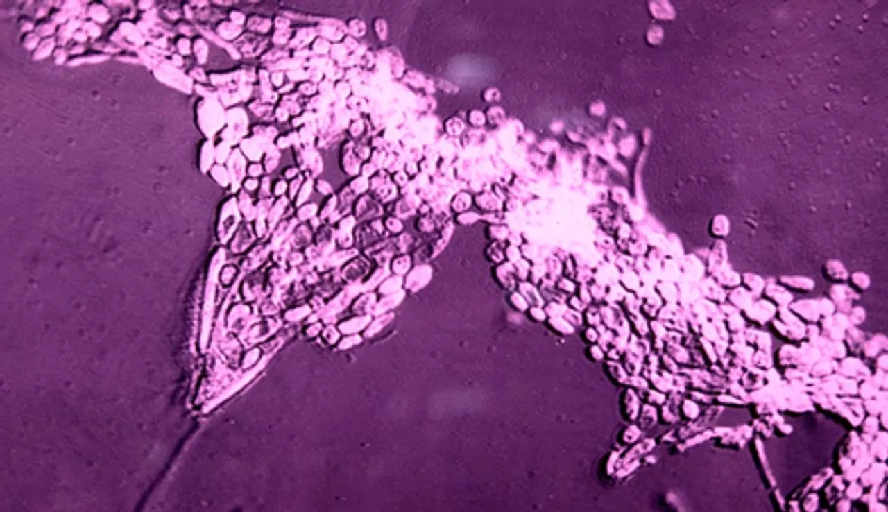 ICMR researchers develop new approach to tackle fungal pathogens