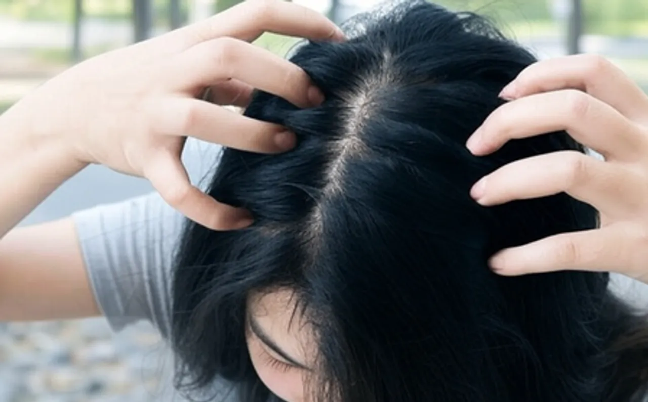 सर्दियों में सिर की खुजली से परेशान? अपनाएं ये आसान उपाय