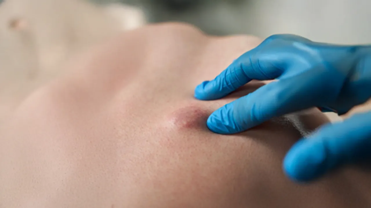 क्या हर गांठ खतरनाक होती है? आयुर्वेद से जानें अर्बुद और ग्रन्थि में फर्क