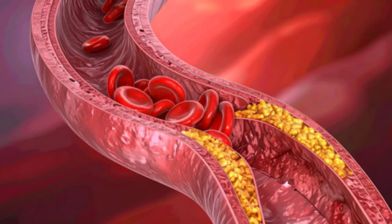 कोलेस्ट्रॉल: खतरनाक नहीं, सिर्फ संतुलन की जरूरत