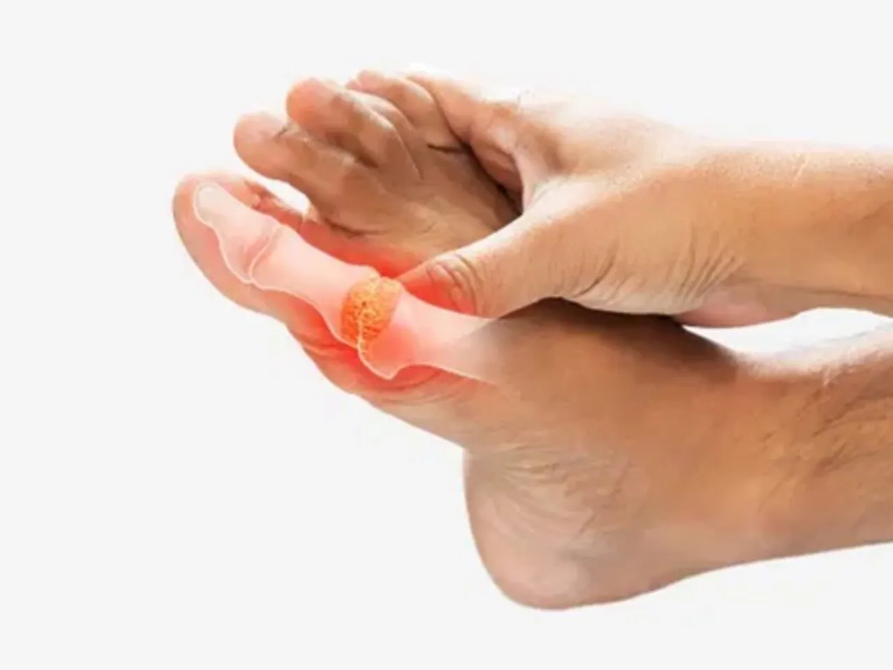 Ayurveda for Arthritis