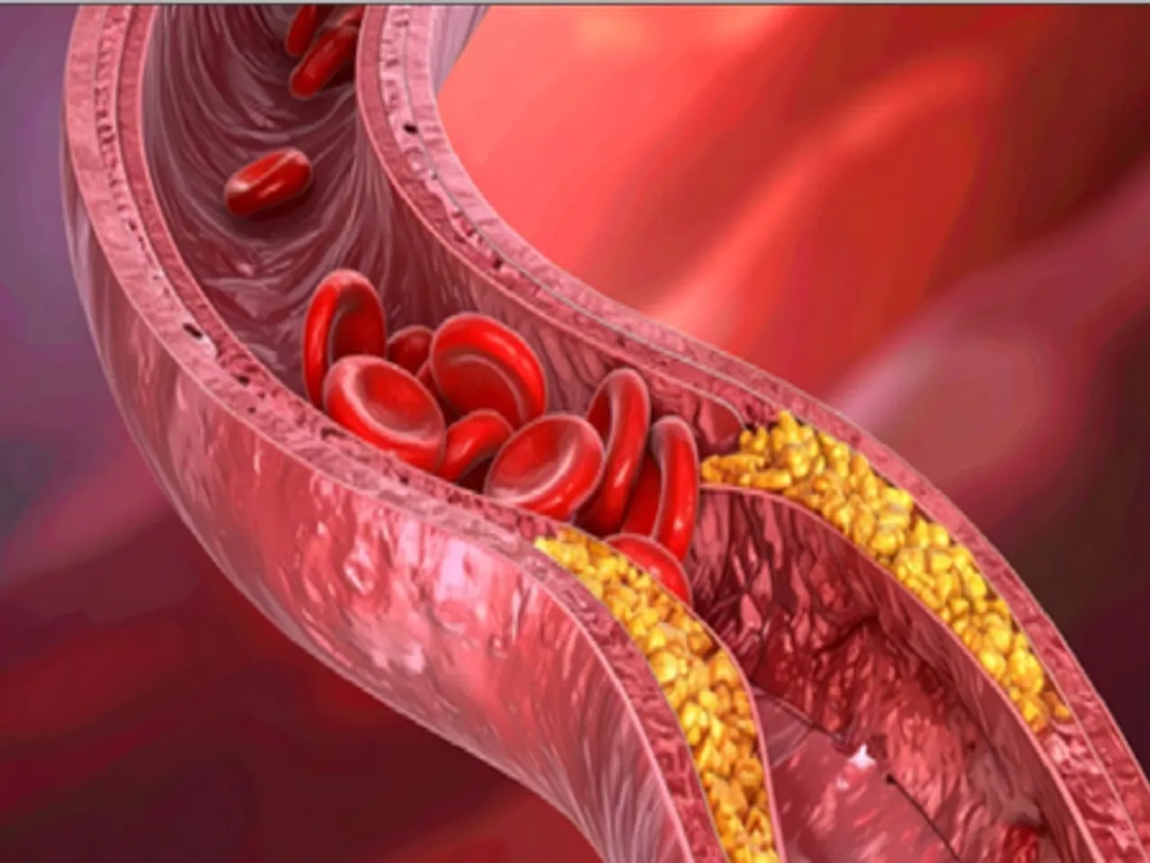 आयरन: शरीर की ऊर्जा का मुख्य स्त्रोत है आयरन, कमी शरीर को कर देगी अधमरा