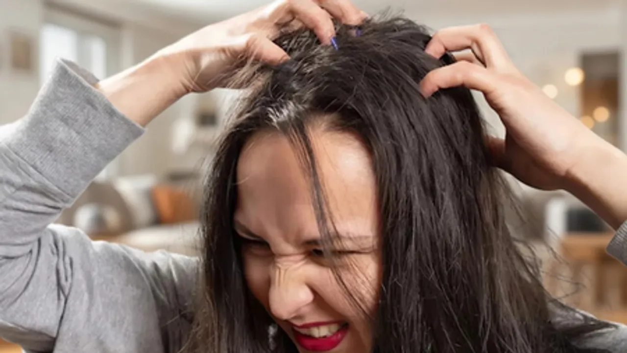 सिर से जूं और लीखों को तुरंत खत्म करेंगे ये उपाय, खुजली और डैंड्रफ से भी मिलेगी राहत