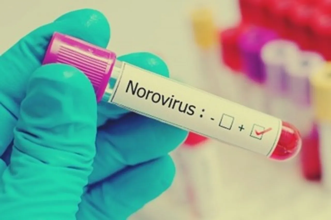 Norovirus infections sicken over 100 students in south China school
