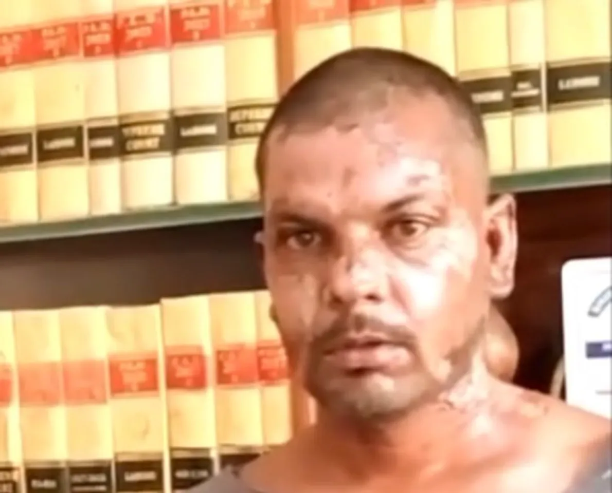 Rights group condemns brutal attack on Christian man in Pakistan