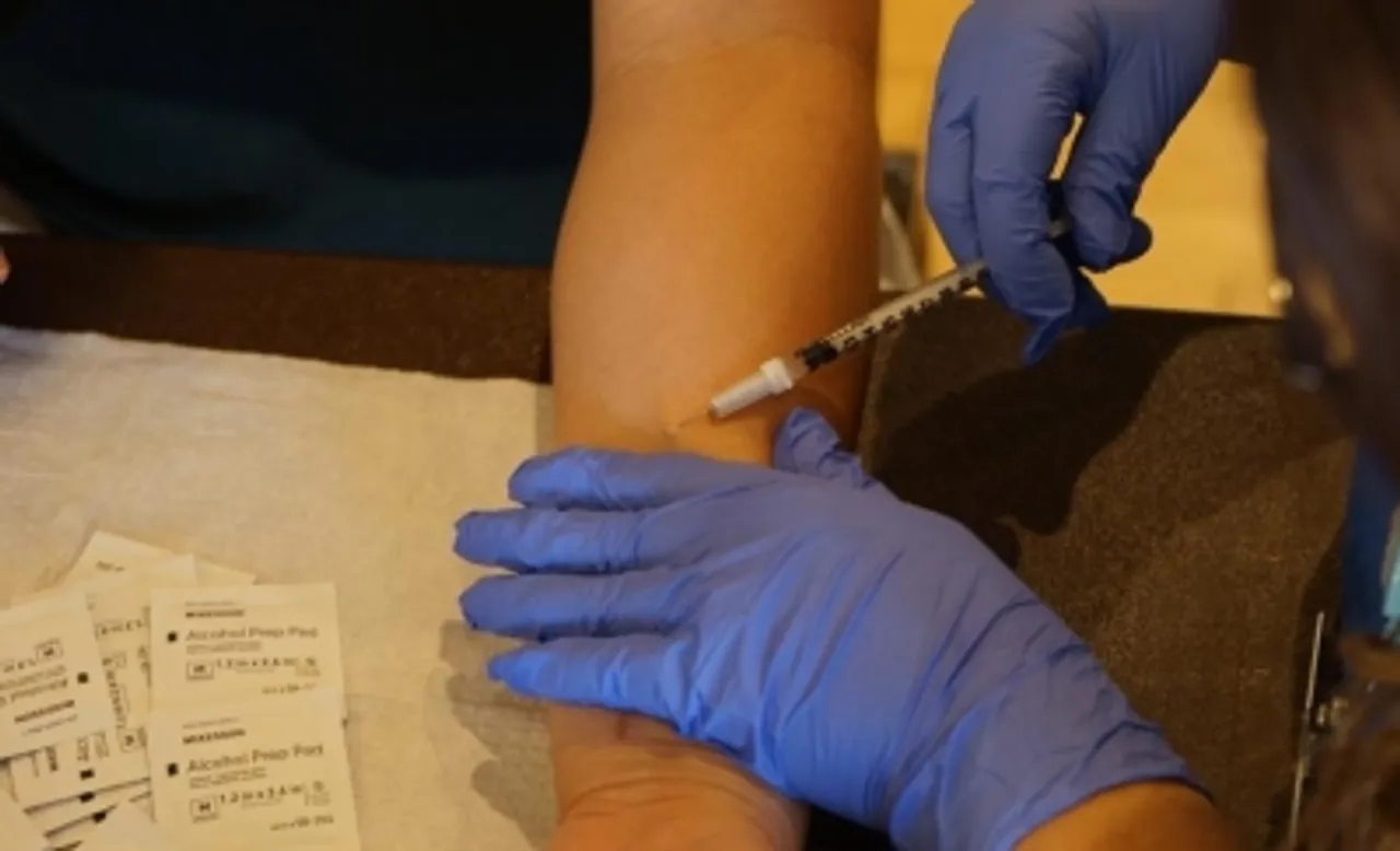 monkeypox vaccine,monkeypox vaccination,
