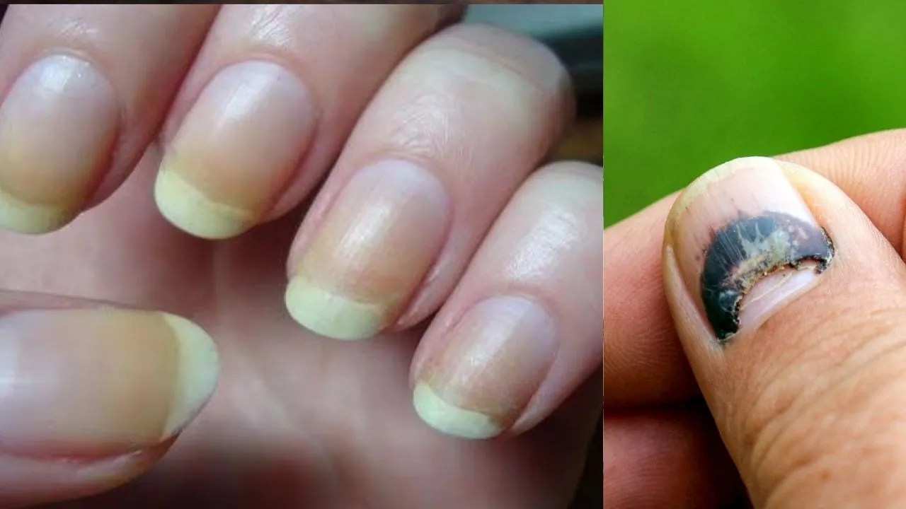 Fingernails 4