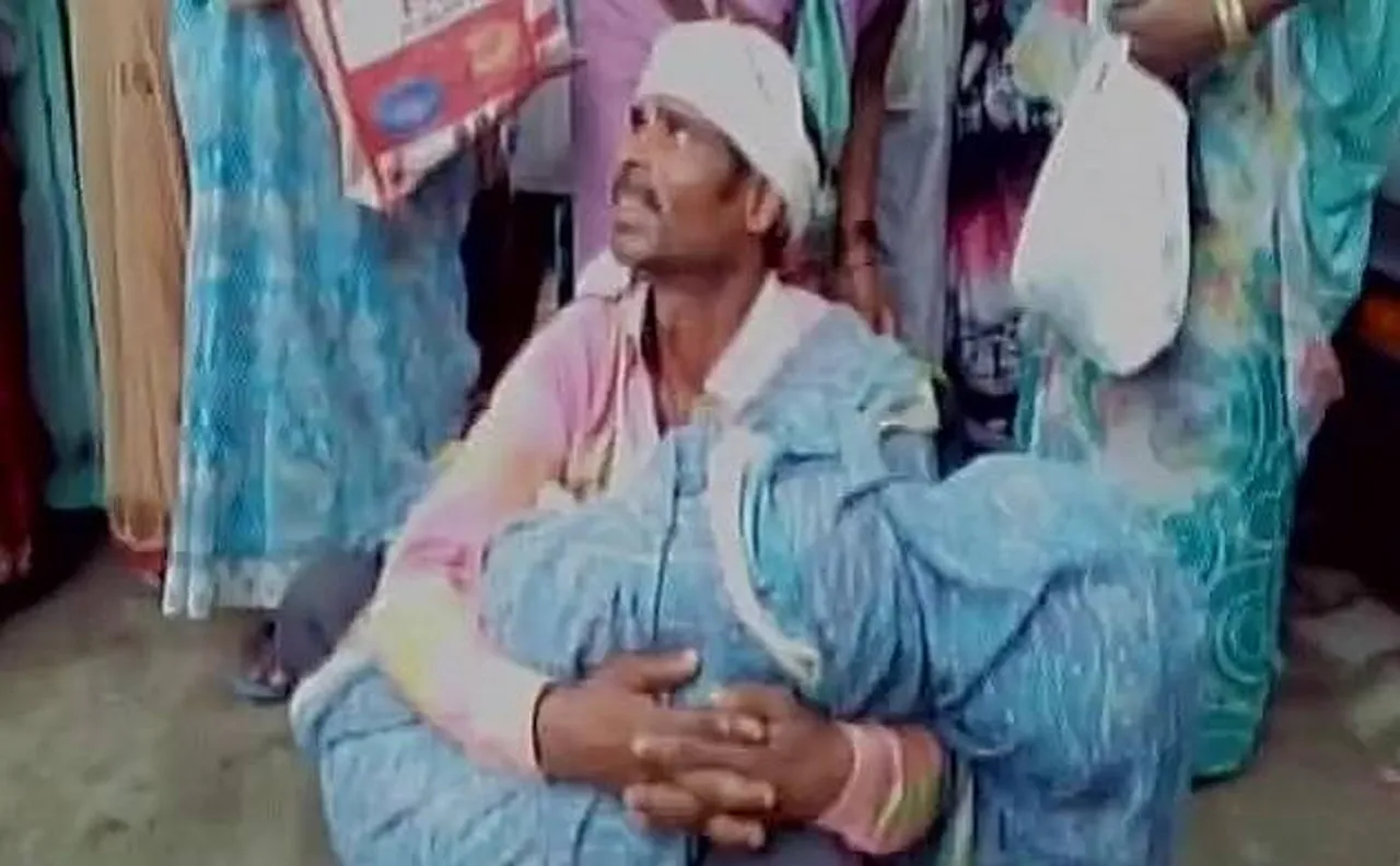 UP: नहीं मिली सरकारी एंबुलेंस, जली हुई बहन को गोद में लेकर भटकता रहा भाई