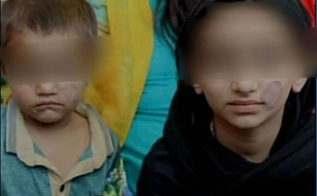 मध्यप्रदेश: बच्चों के चेहरे पर स्टाम्प लगाने वाली लेडी गार्ड सस्पेंड
