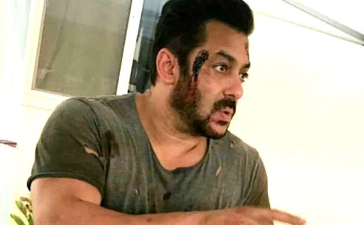 'टाइगर जिंदा है' के सेट पर चोटिल नजर आए सलमान खान, वायरल हुई PHOTO