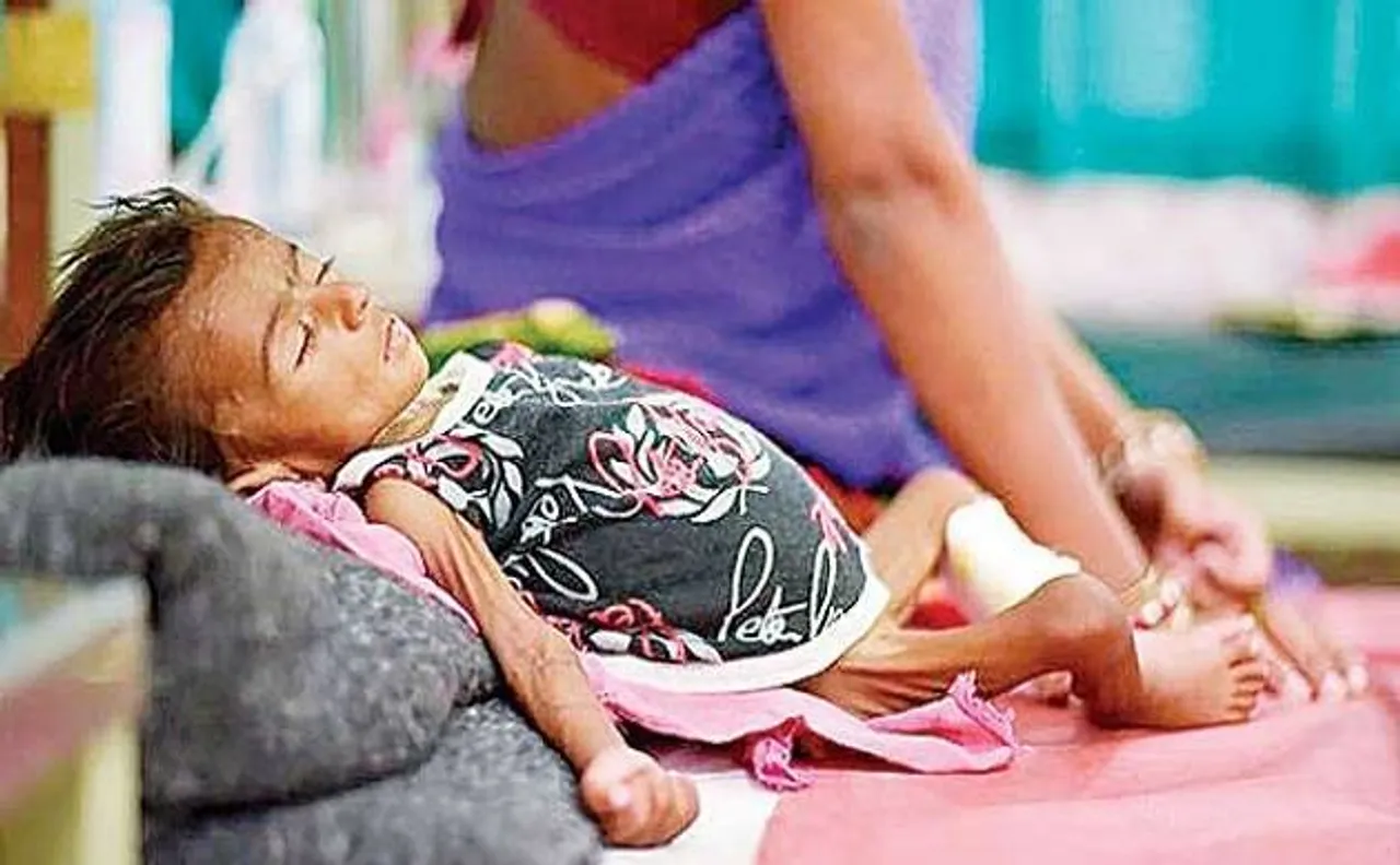 उद्योग में नंबर 2 पर रहने वाले गुजरात में कुपोषण की 'निराशाजनक' तस्वीर