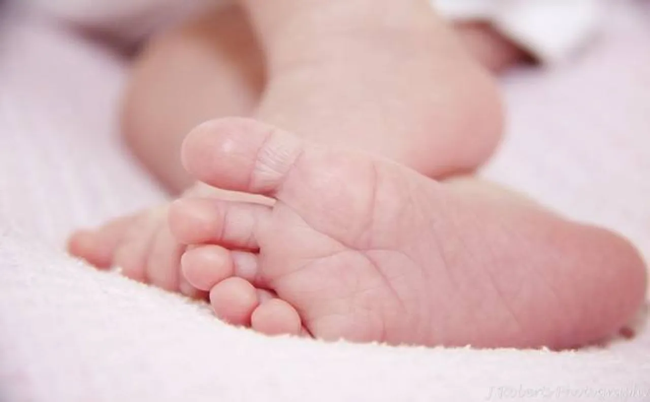 ओडिशा में एक-दूसरे से जुड़ी जुड़वां बच्चियों की इलाज के दौरान मौत