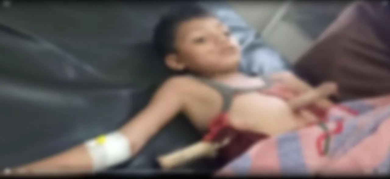 जाको राखे...8 साल के बच्‍चे के पेट के आरपार हो गई लकड़ी, खुद चलकर पहुंचा घर,देखें VIDEO