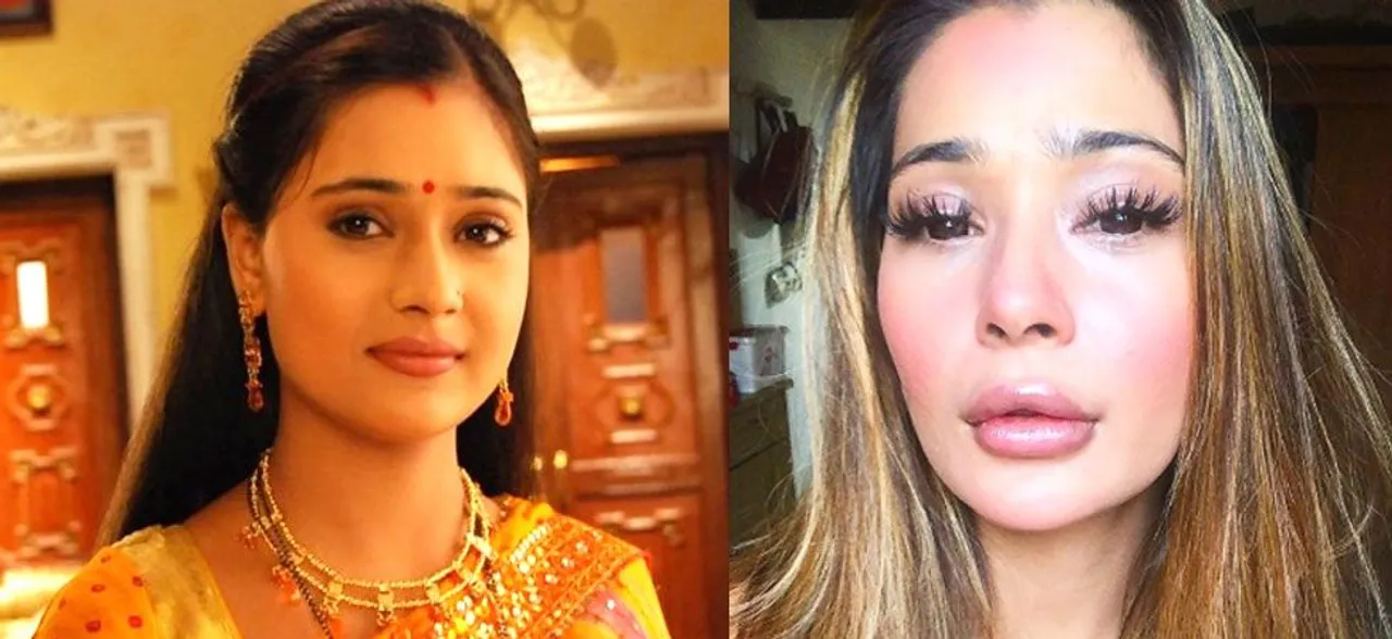 लिप सर्जरी की वजह से बिगड़ा 'विदाई' एक्ट्रेस सारा खान का चेहरा, यूजर्स बोले- राखी सावंत की बहन...