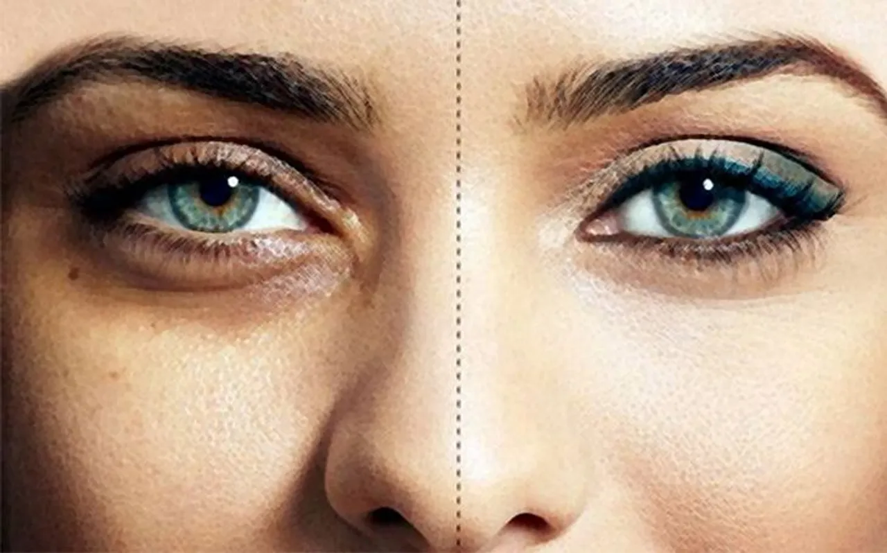 इन घरेलू नुस्खों को अपनाकर 10 दिन में दूर करें आंखों के डार्क सर्कल