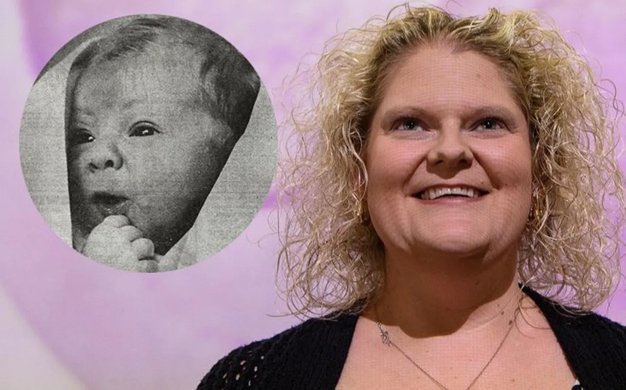 Louise Brown, वो महिला जिस पर आज भी मेडिकल साइंस को है गर्व, जानिए क्या है कारण
