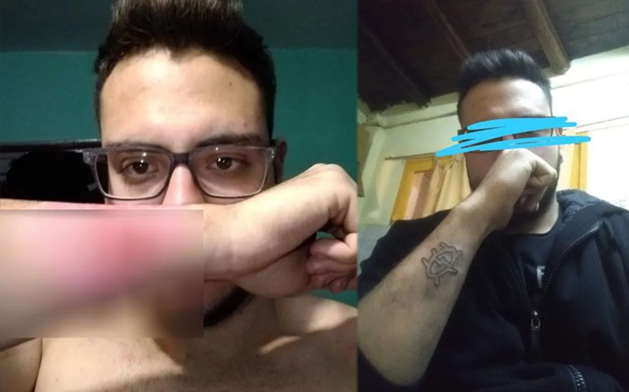 युवक को पसंद नहीं था हाथ पर बना Tattoo, हटाने के लिए अपनाया ये भयानक उपाय, जानकर खड़े हो जाएंगे रोंगटे