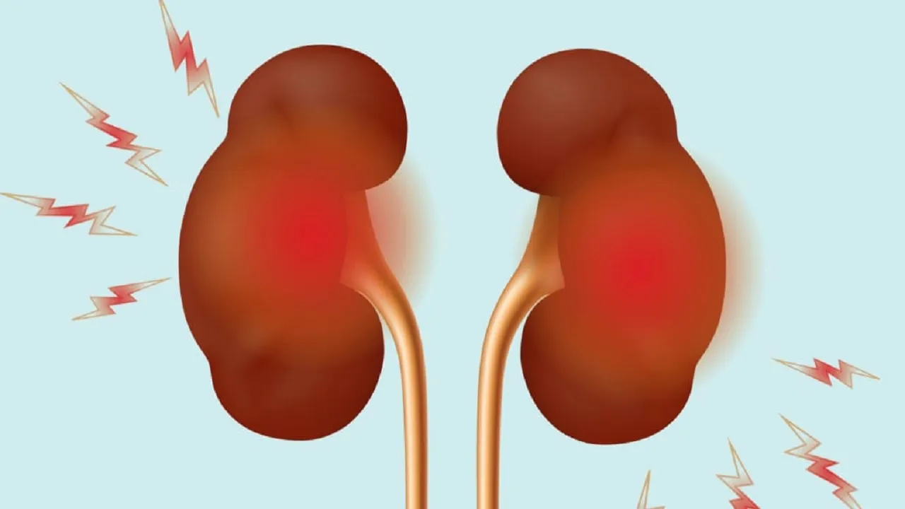 kidney